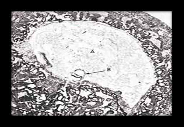 62 Hva er meningen med livet? Figur 3: På dette mikrofotografiet kan vi se det suspenderte embryoet (merket B) i alaqah-stadiet (omtrent 15 dager gammel) i morens livmor.