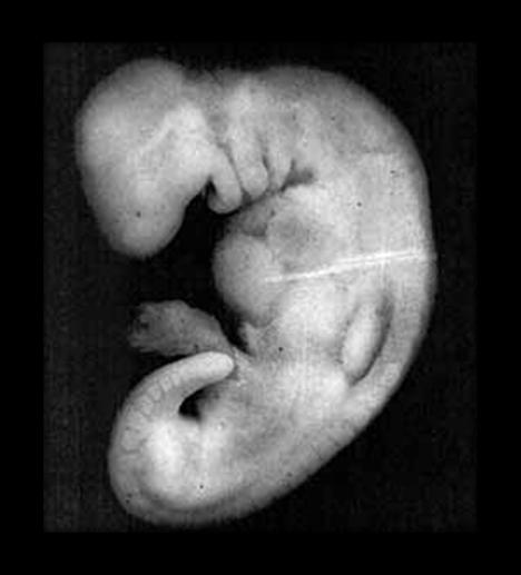 63 Hva er meningen med livet? De tre betydningene av ordet alaqah stemmer nøyaktig overens med beskrivelsen av embryoet i alaqah-stadiet.