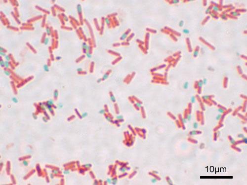 Antibiotikaresistente bakterier kan forekomme i mat NB!