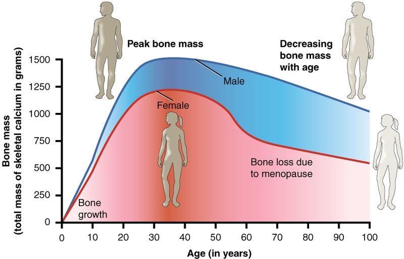 1, Osteoporose er en tilstand karakterisert ved økt risiko for brudd.