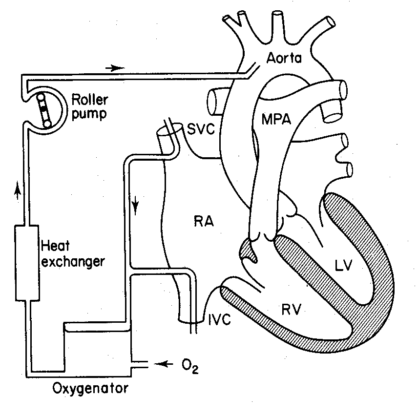 Intraoperative skader - total