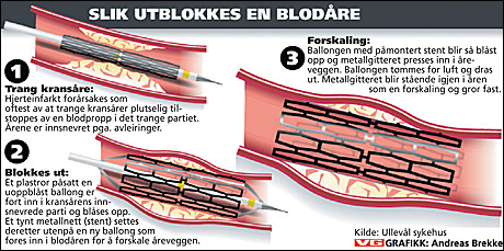 De store endringene som skjer som vi ikke merker før de er der Magesår: fra kniv til tablett