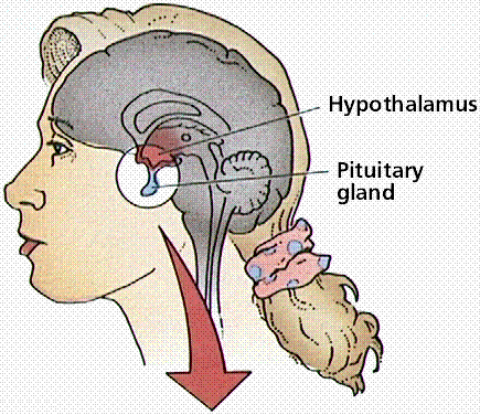 HYPOTHALAMUS Sitter like over hjernestammen, rett under thalamus Kontrollerer