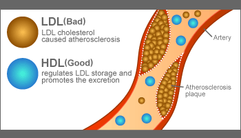 Very low density lipoprotein (VLDL) er ofte økt dersom triglyseridnivået er høyt. VLDL- partikkelen er det triglyseridrike forstadiet til LDL.