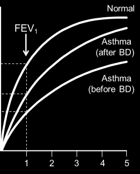 SPIROMETRI Flow Normal Testkvalitet Kurve hengekøye?