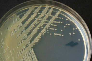 Penicillin Resistant Streptococcus pneumoniae (PRSP) Bakteriemi (Turett, CID 1999) Retrospektiv studie n=462 233 HIV-positive Høygradig (MIC>1.