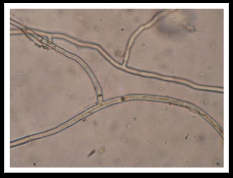 Rhizoctonia (Rhizoctonia solani) Angripes: Raigrass Kveinarter Gunstig miljø: Varmt (15-30 C) og fuktig Høyt nitrogen nivå Mye filt Symptomer: Røykeringer kortklipt