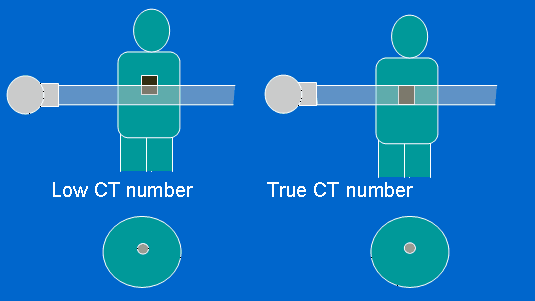 Partial volume effect Ting å tenke på Store objekter representeres i flere snitt, og