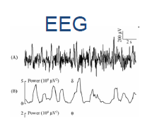 -Mer theta aktivitet -Langsom alpha bølger< 7hz Adamis et al, 2005 Funktionell avbildning av hjärnan med elektroencefalo-grafi (EEG) och kvantitativ EEG Slutsats: Funktionell