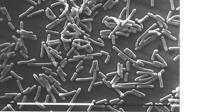 Hvorfor er Listeria en problembakterie?