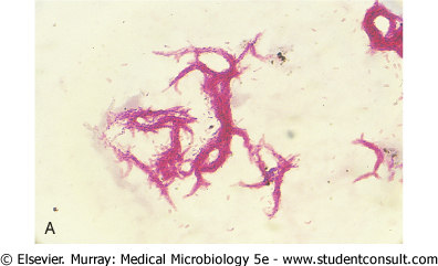 Acid-fast stains of Mycobacterium tuberculosis.