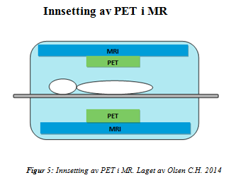 Side ved side: PET og MR er plassert ved siden av hverandre med PET-komponenten i hodeenden. Dette vil gi mindre forstyrrelser mellom PET-detektoren og magnetfeltet.