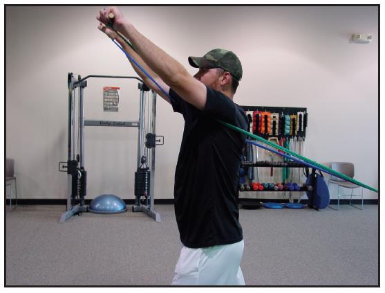 Behandling av scapula dyskinesi Aktivering og styrketrening av kraftpar som kontrollerer scapulas bevegelser Nøkkelmuskler:
