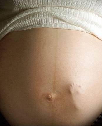Mikronæringsstoffer hos gravide, ammende og spedbarn A.L.