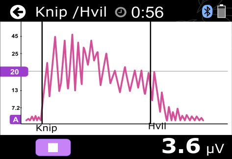 terskelverdien øke/minke raskere). Se mer om terskelverdi nedenfor (1). Du starter programmet ved å trykke på Start. Se mer om igangsetting av programmet nedenfor (2).