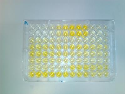 Metoder 7. Substrat Platen ble vasket 5 ganger med PBS Tween (100 µl per brønn), PBS ble stående i platen ca 30 sekunder mellom hvert vasketrinn for å fjerne resterende enzym.
