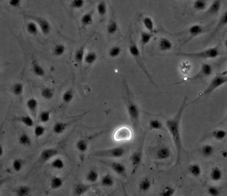 2 IFN uttrykk i mikskultur fra hjerte til Atlantisk laks etter in vitro poly I:C stimulering. Det ble utført tre separate forsøk med poly I:C stimulering av mikskulturer.