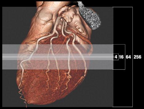 Multislice CT 320 detektorrader