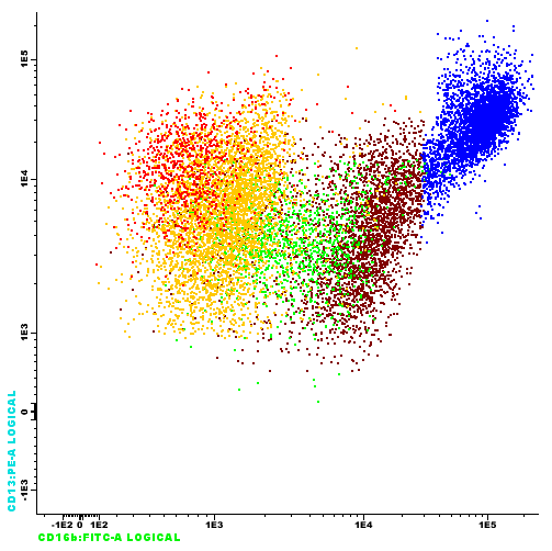 Flowcytometri: Normal utmodning av neutrofile hos 3 måneder gammel: CD 13 CD 11b CD 13 CD 11b CD 16b CD 16b Opphopning av