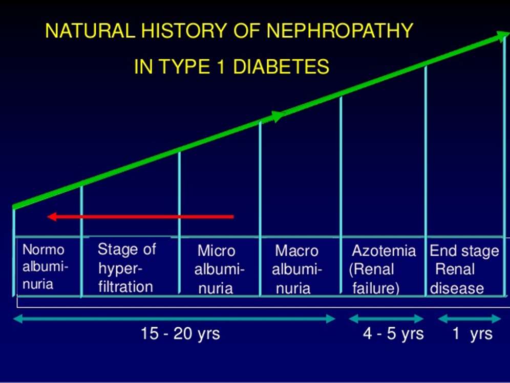 .ved type 2 diabetes Ssymptomer= diagnose Naresh