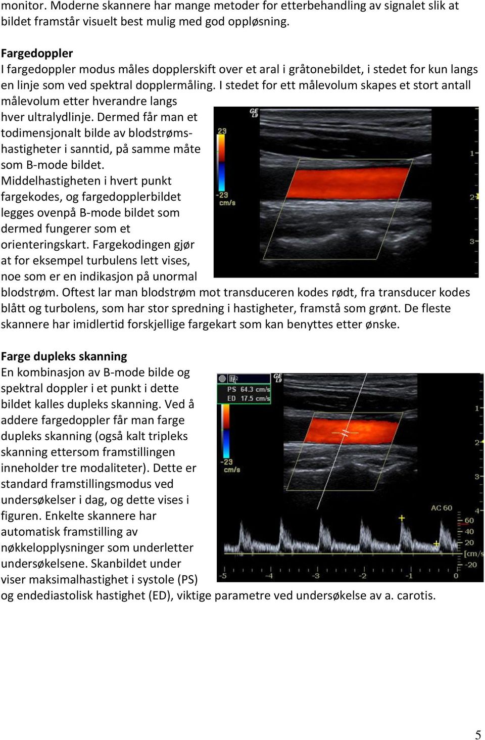 I stedet for ett målevolum skapes et stort antall målevolum etter hverandre langs hver ultralydlinje.