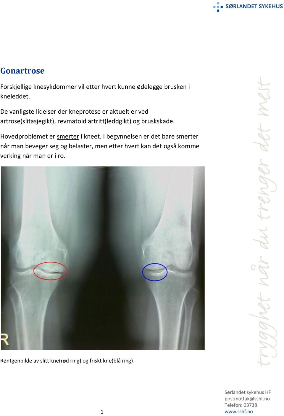 bruskskade. Hovedproblemet er smerter i kneet.