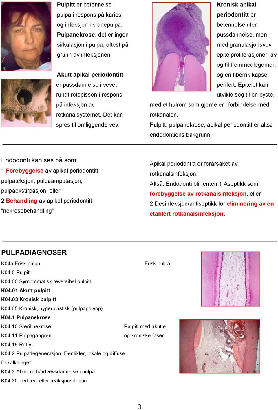 Kronisk apikal periodontitt er betennelse uten pussdannelse, men med granulasjonsvev, epitelproliferasjoner, av og til fremmedlegemer, og en fiberrik kapsel perifert.