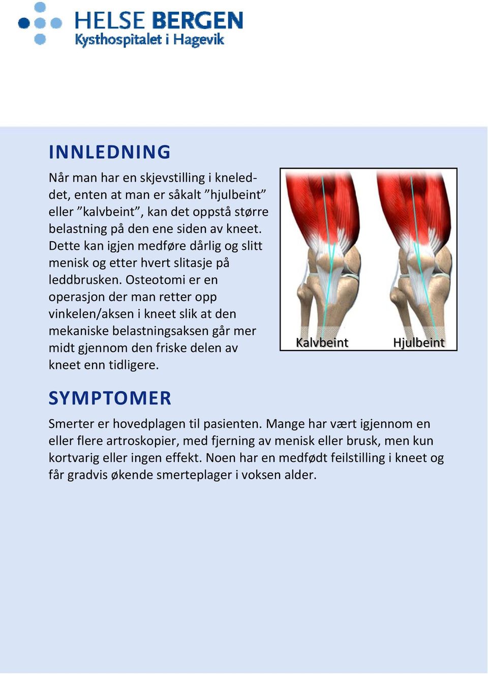 Osteotomi er en operasjon der man retter opp vinkelen/aksen i kneet slik at den mekaniske belastningsaksen går mer midt gjennom den friske delen av kneet enn tidligere.