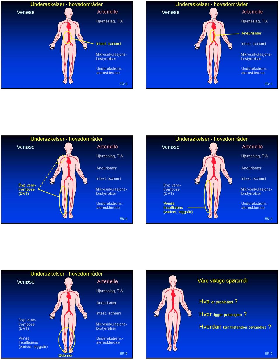 - aterosklerose Undersøkelser - hovedområder Venøse Arterielle Hjerneslag, TIA Undersøkelser - hovedområder Venøse Arterielle Hjerneslag, TIA Aneurismer Aneurismer Intest. ischemi Intest.