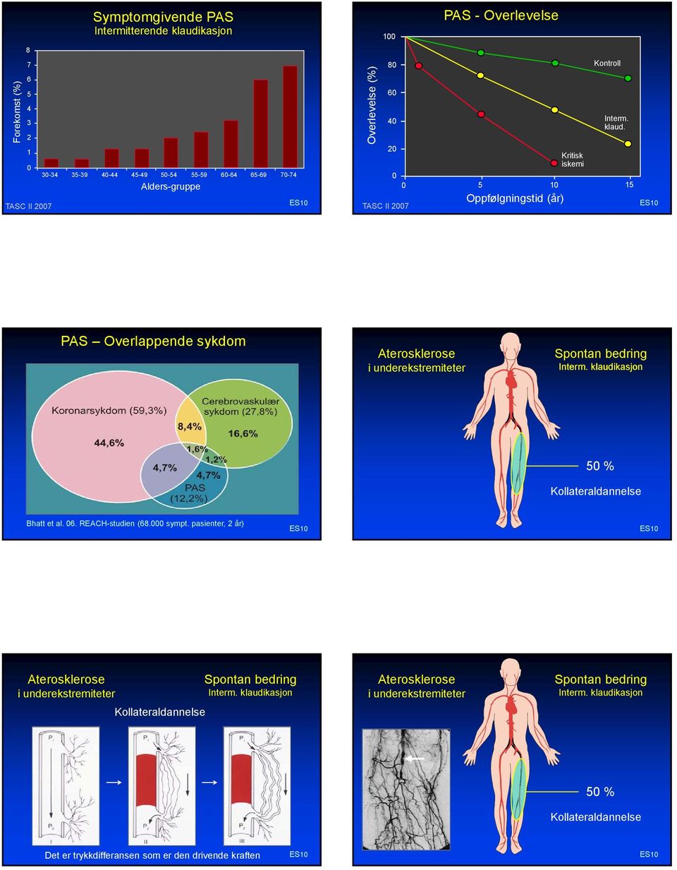 15 PAS Overlappende sykdom Aterosklerose i underekstremiteter Spontan bedring Interm. klaudikasjon 50 % Kollateraldannelse Bhatt et al. 06. REACH-studien (68.000 sympt.