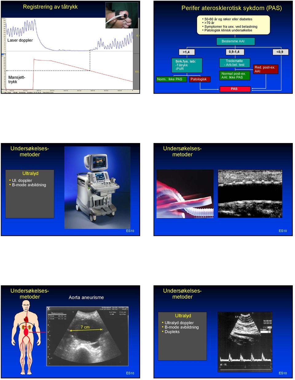 lab: -Tåtrykk -PVR Patologisk Tredemølle - Arb.bel. test Normal post-ex. AAI: Ikke PAS Red. post-ex. AAI PAS Undersøkelsesmetoder Undersøkelsesmetoder Ultralyd Ul.