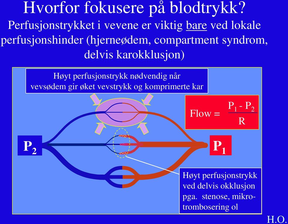 compartment syndrom, delvis karokklusjon) Høyt perfusjonstrykk nødvendig når vevsødem