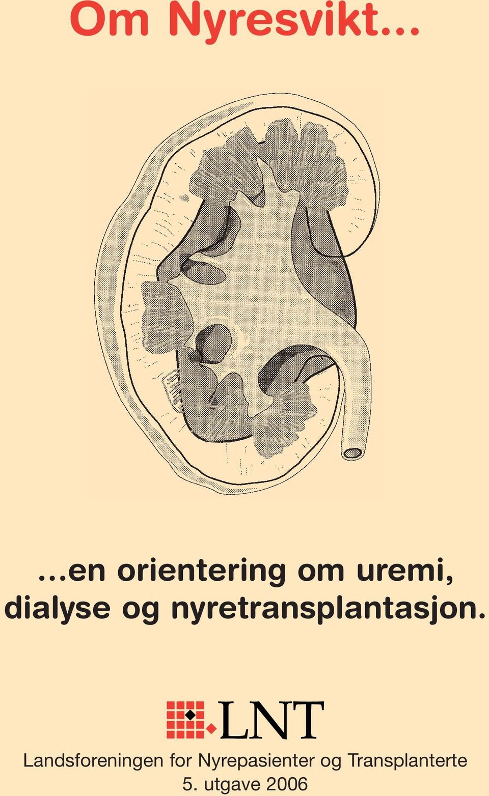 dialyse og nyretransplantasjon.