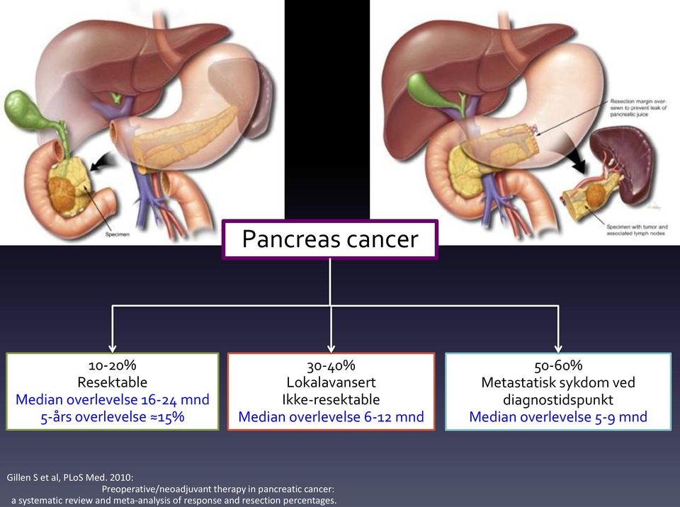 diagnostidspunkt Median overlevelse 5-9 mnd Gillen S et al, PLoS Med.