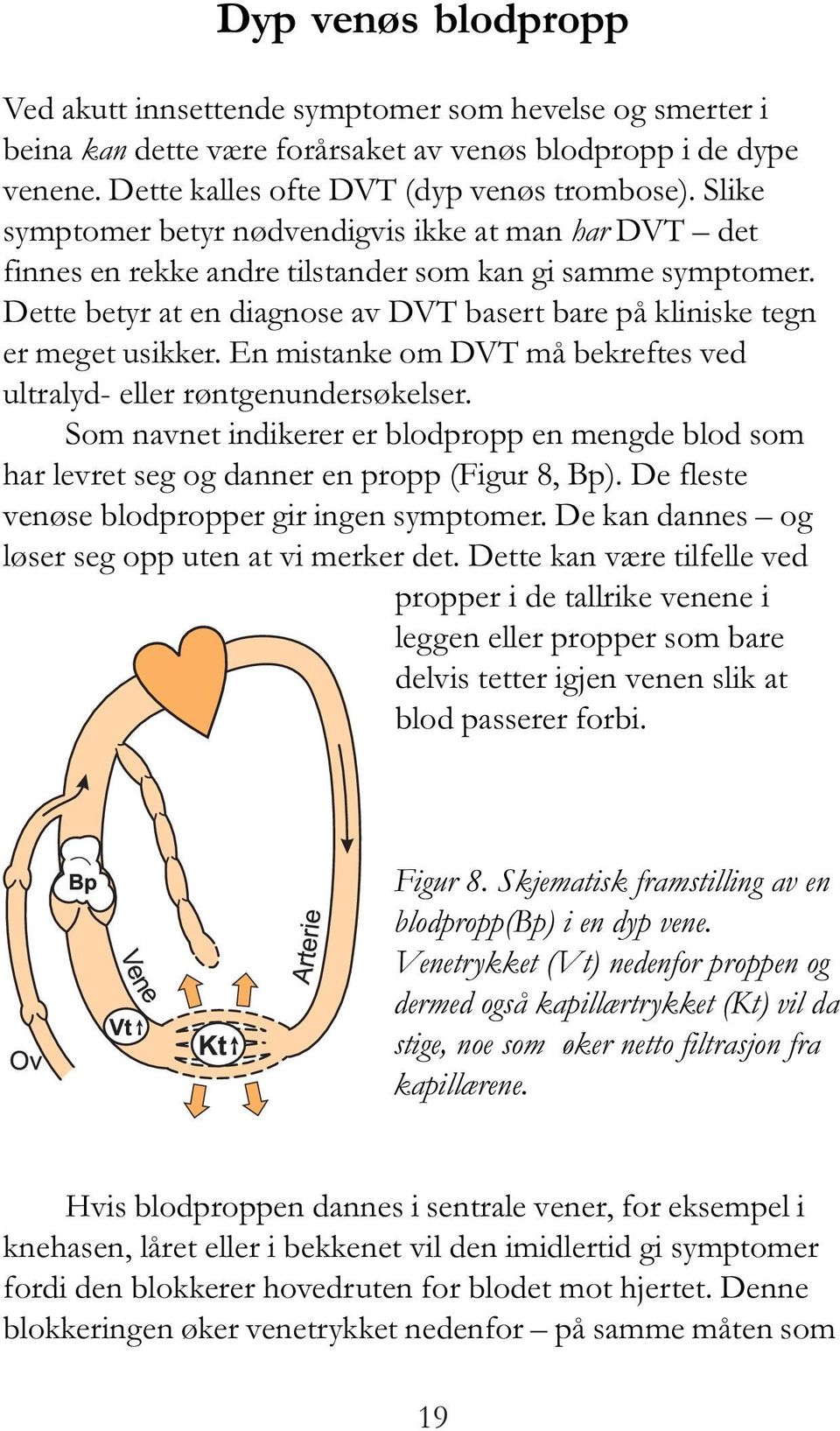 En mistanke om DVT må bekreftes ved ultralyd- eller røntgenundersøkelser. Som navnet indikerer er blodpropp en mengde blod som har levret seg og danner en propp (Figur 8, Bp).