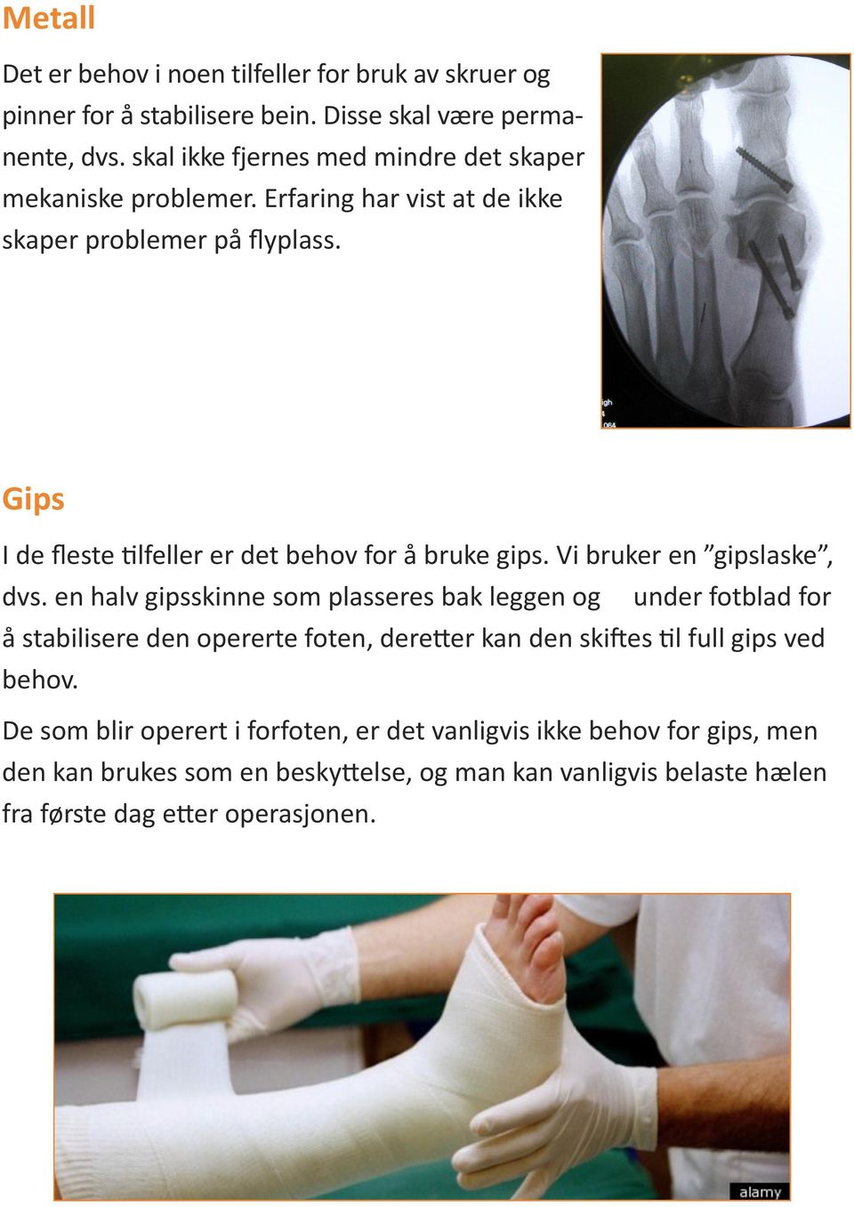 Gips I de fleste tilfeller er det behov for å bruke gips. Vi bruker en gipslaske, dvs.