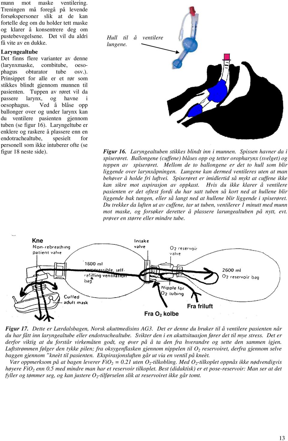 Prinsippet for alle er et rør som stikkes blindt gjennom munnen til pasienten. Tuppen av røret vil da passere larynx, og havne i oesophagus.