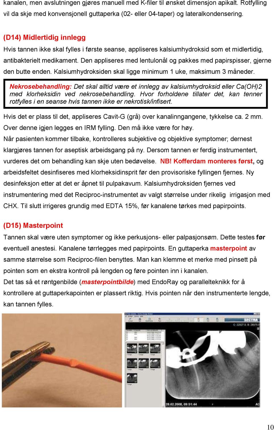 Den appliseres med lentulonål og pakkes med papirspisser, gjerne den butte enden. Kalsiumhydroksiden skal ligge minimum 1 uke, maksimum 3 måneder.