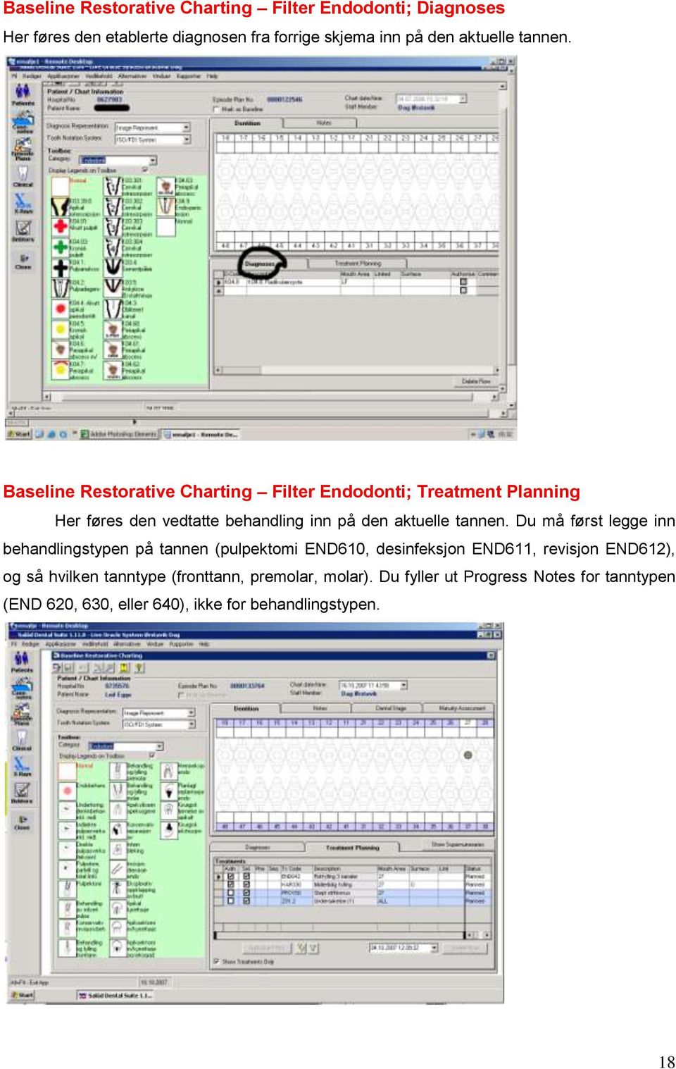 Baseline Restorative Charting Filter Endodonti; Treatment Planning Her føres den vedtatte behandling inn på den aktuelle  Du må