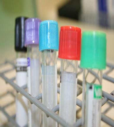 Endringer i serumlipider etter at forsøkspersoner har
