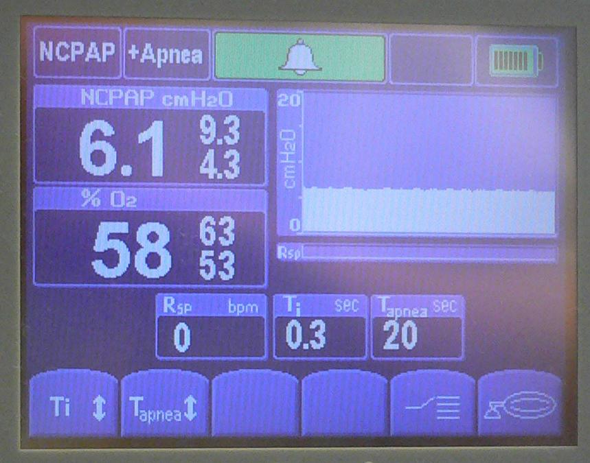 4 7. MODE / HOVEDMENY: En velger mode ved å trykke nede i displayet: A. NCPAP = Nese CPAP ( uten trykkstøtte ). B. Nese CPAP med respirasjonsfrekvens monitorering / apnoealarm ( uten trykkstøtte ). C. Bi BiPhasic = CPAP med trykkstøtte.