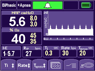 5 10. BiPhasic mode: Diagram Tallkolonner CPAP med trykkstøtte. Gir bare innstilt frekvens, inspirasjons tid og trykk. Uavhengig av barnets egenrespirasjon.