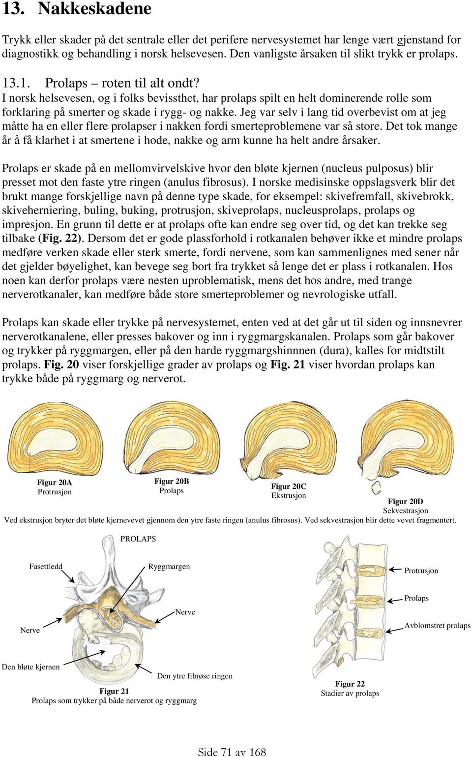 I norsk helsevesen, og i folks bevissthet, har prolaps spilt en helt dominerende rolle som forklaring på smerter og skade i rygg- og nakke.