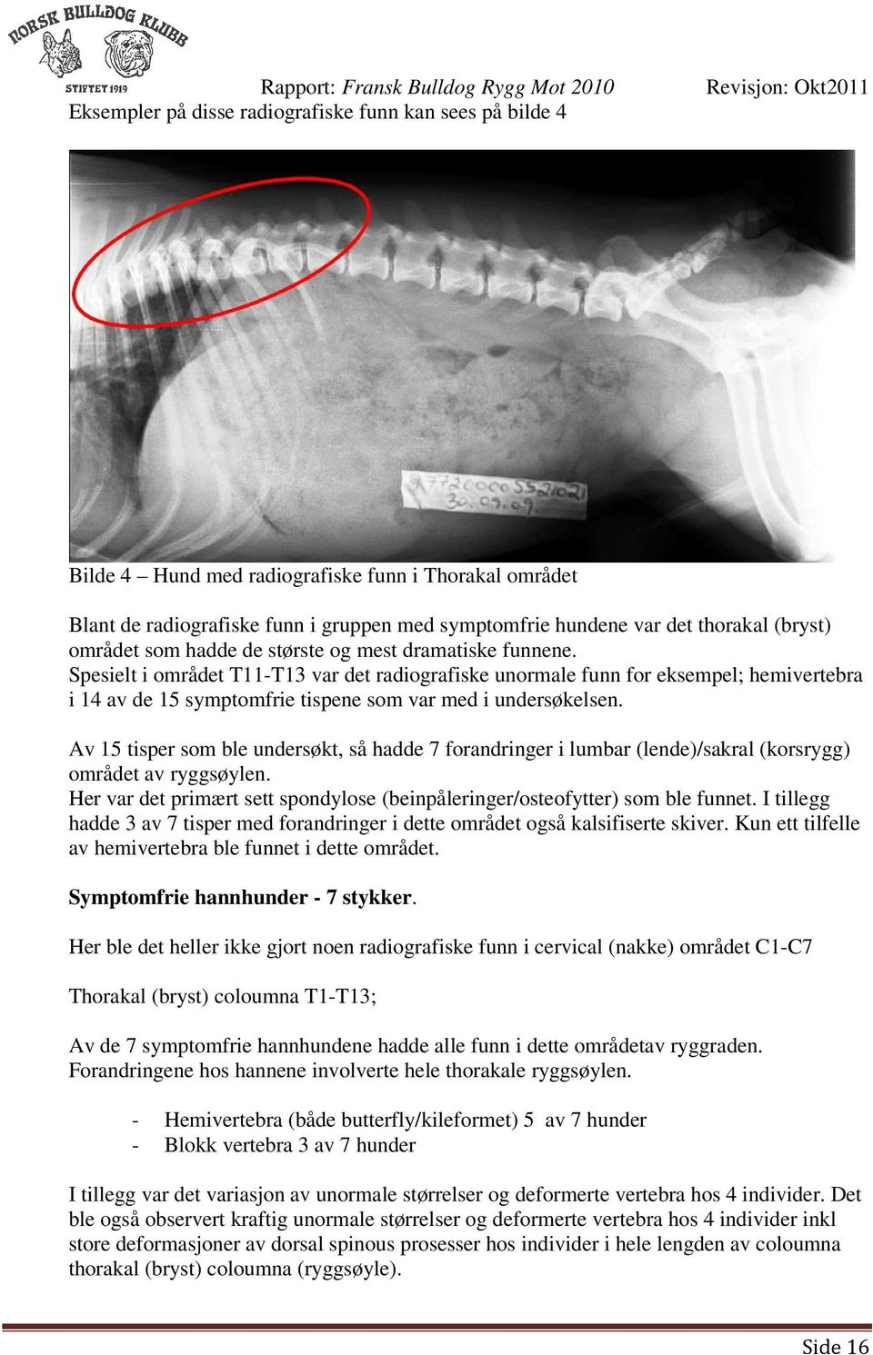 Spesielt i området T11-T13 var det radiografiske unormale funn for eksempel; hemivertebra i 14 av de 15 symptomfrie tispene som var med i undersøkelsen.