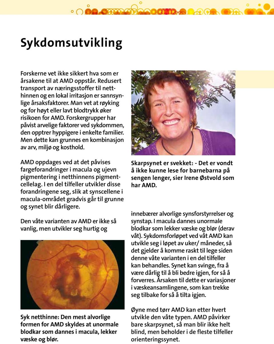 Men dette kan grunnes en kombinasjon av arv, miljø og kosthold. AMD oppdages ved at det påvises fargeforandringer i macula og ujevn pigmentering i netthinnens pigmentcellelag.