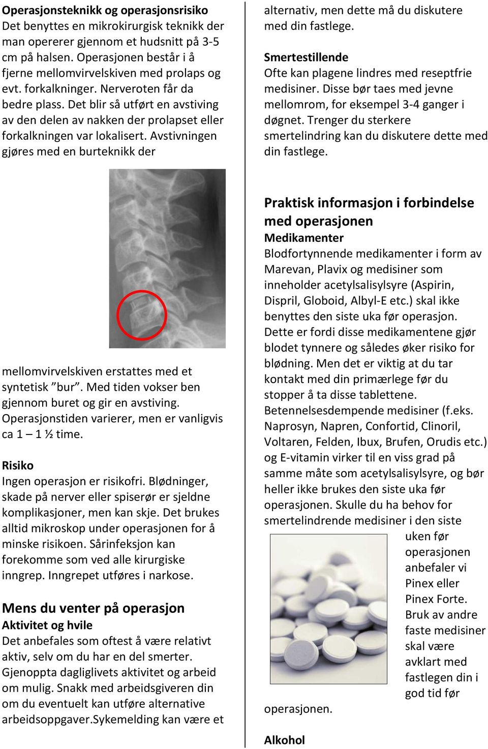 Det blir så utført en avstiving av den delen av nakken der prolapset eller forkalkningen var lokalisert.