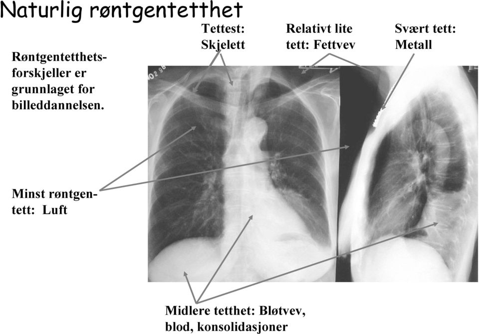 Tettest: Skjelett Relativt lite tett: Fettvev Svært