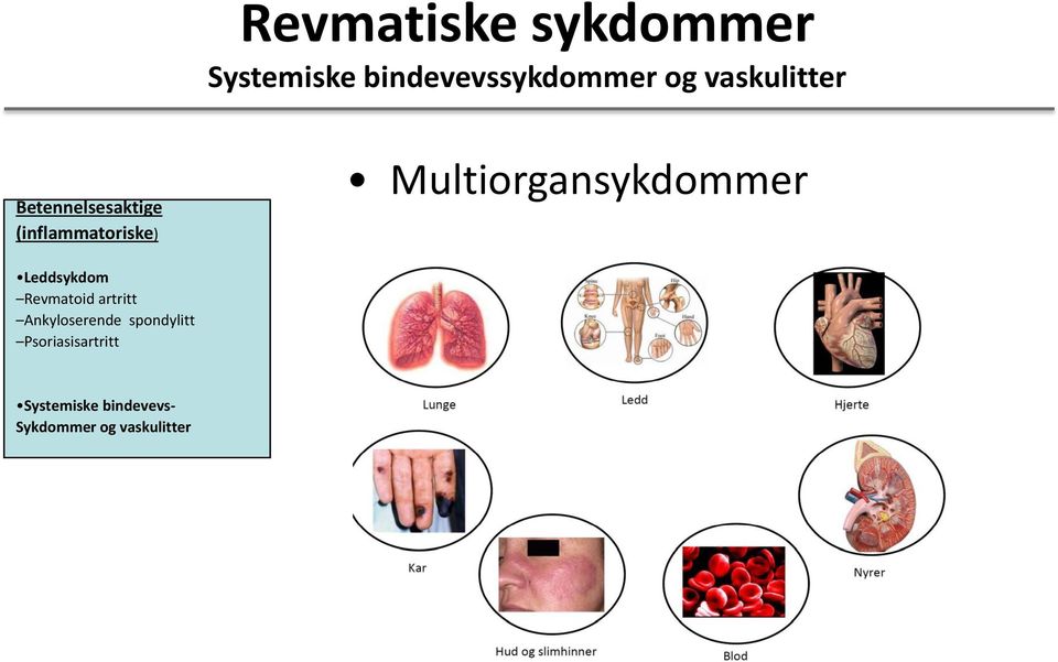 Multiorgansykdommer Leddsykdom Revmatoid artritt