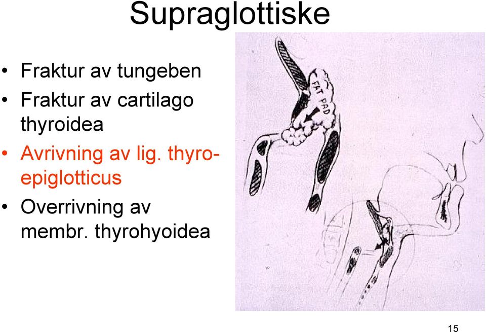 Avrivning av lig.