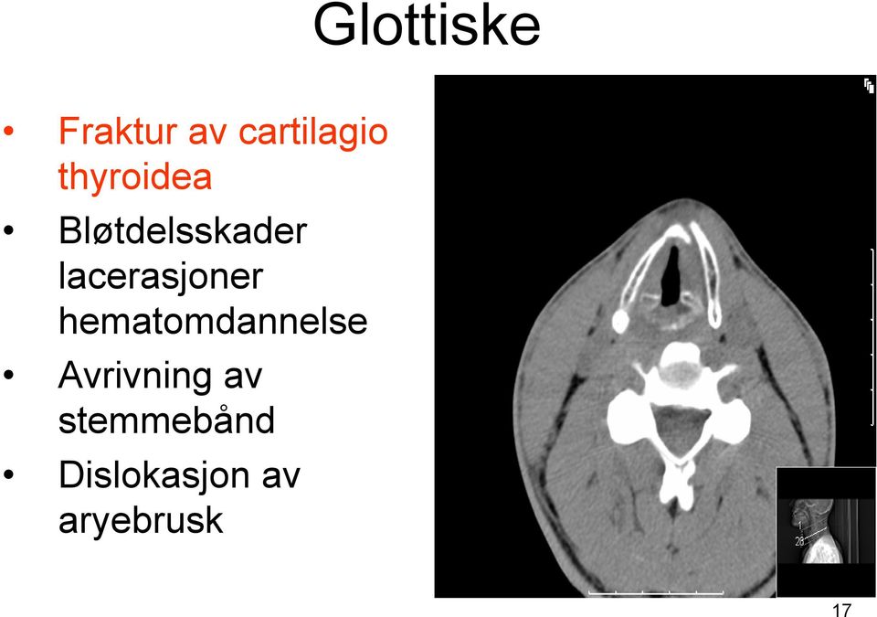 lacerasjoner hematomdannelse